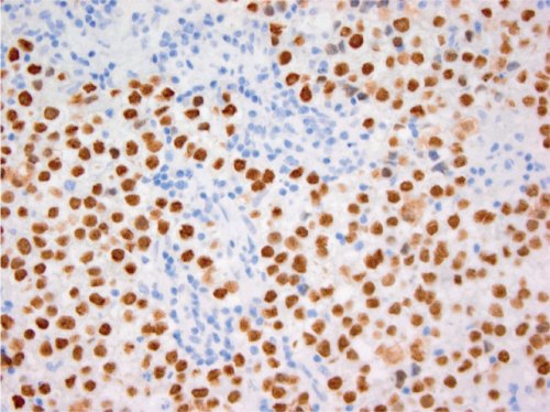 1574411479818784.jpg x_8295226818_m.jpg