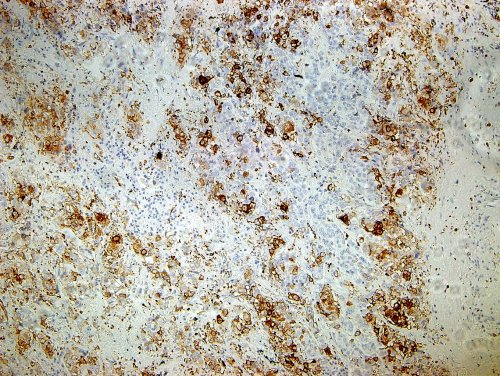 1574412982204325.jpg x_8555226819_m.jpg