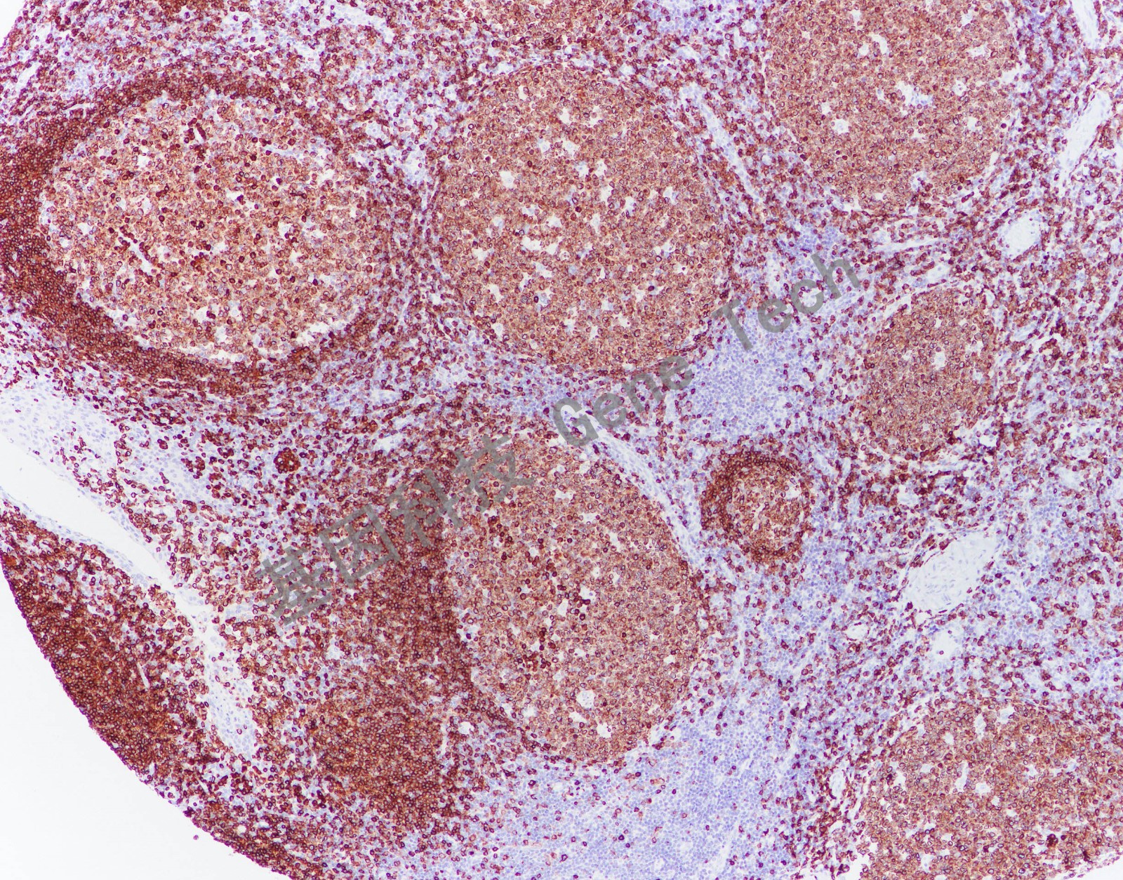 1617873243161848.jpg 1617873243161848.jpg