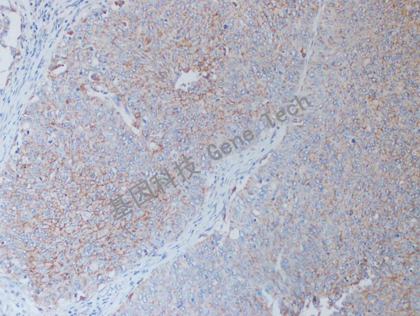 1625799885230733.jpg 1625799885230733.jpg