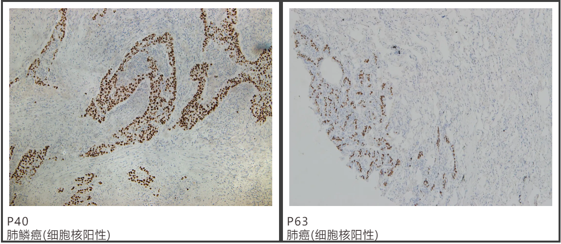 1635746386641683.png 肺癌8.png