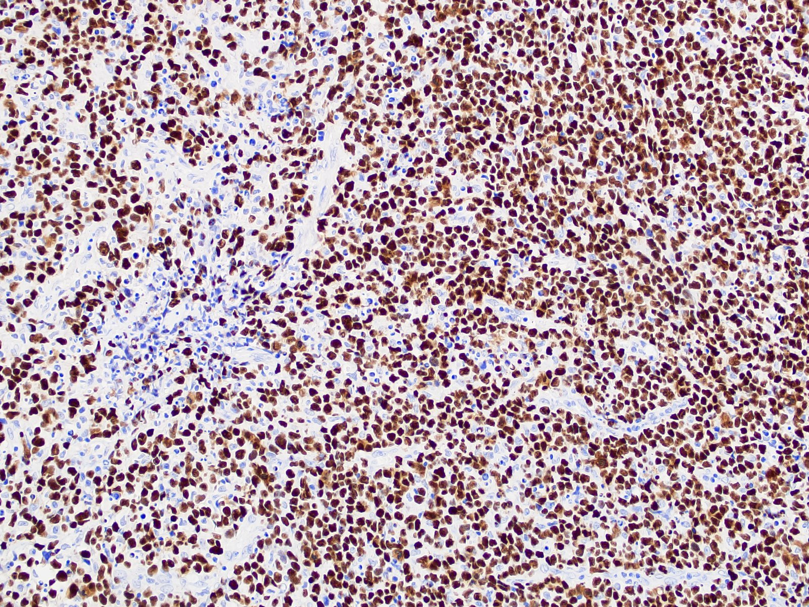 1637638172212351.jpg 1637638172212351.jpg