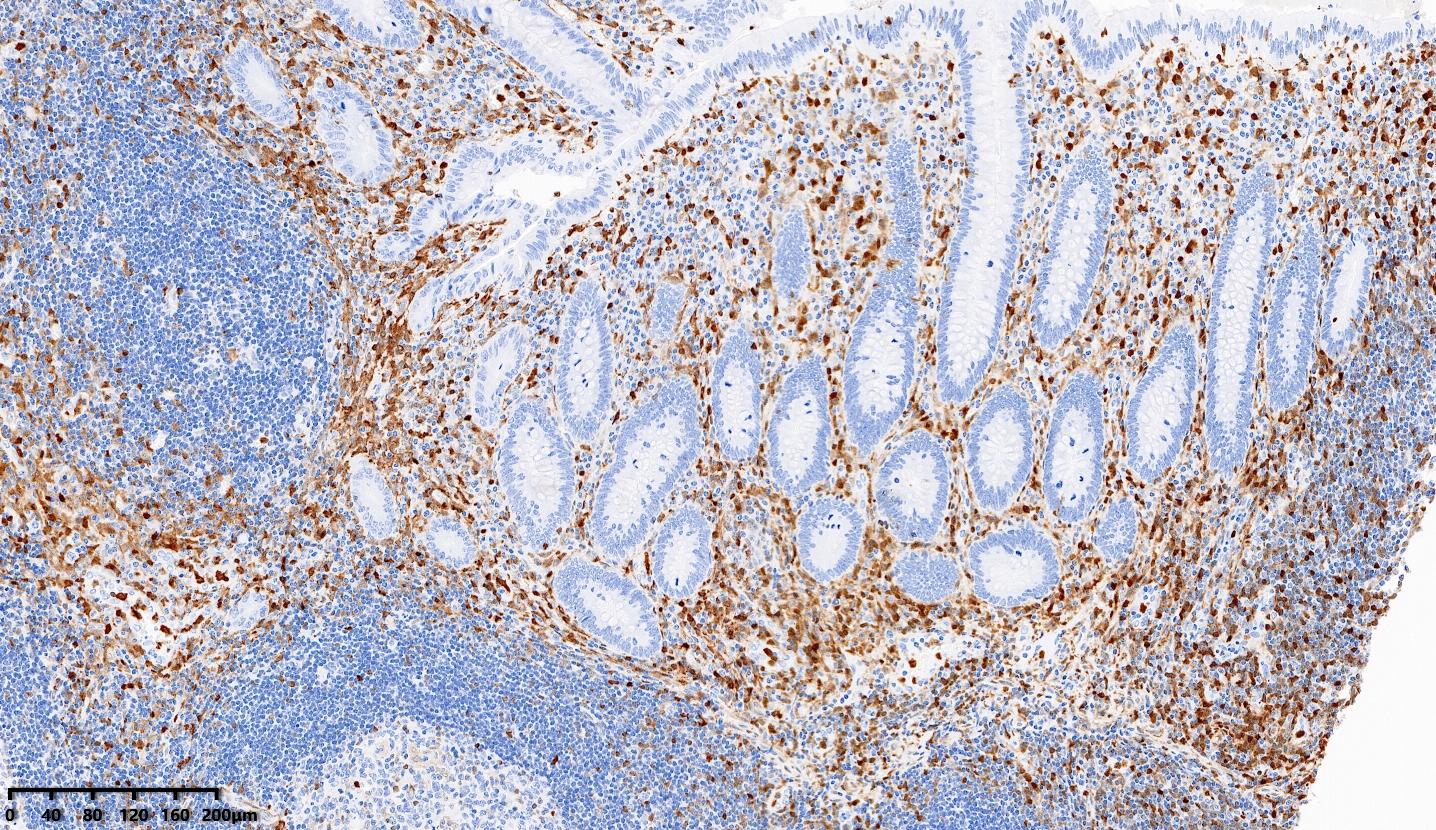 1638433090140624.jpg 1638433090140624.jpg