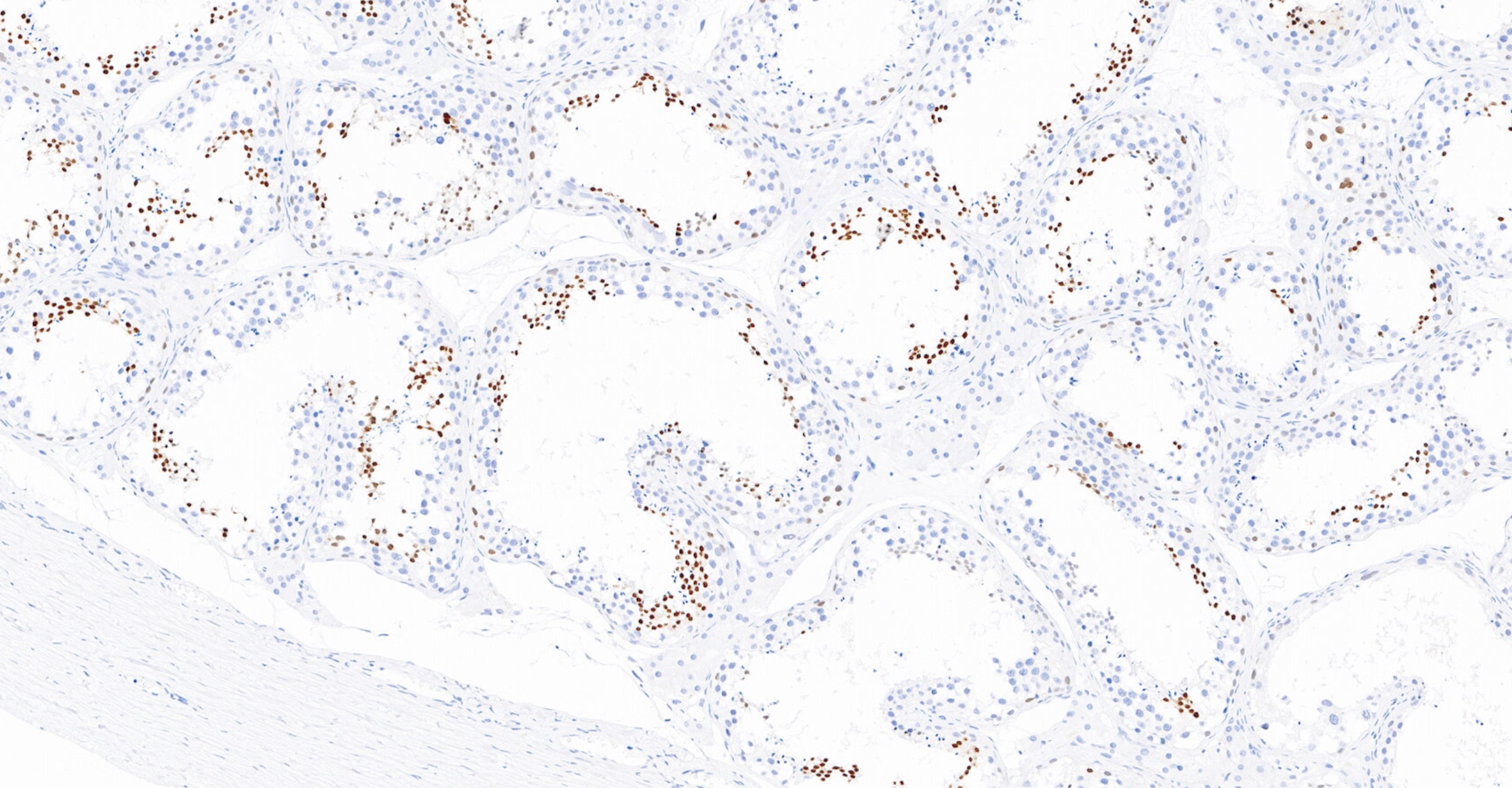 1640845347145976.jpg 1640845347145976.jpg