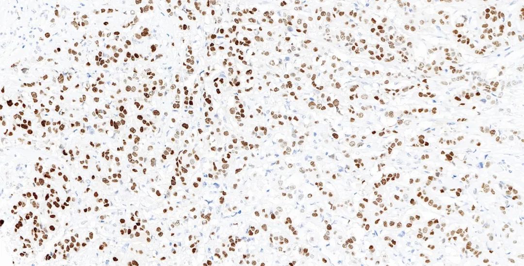 1651130999194192.jpg 640.jpg