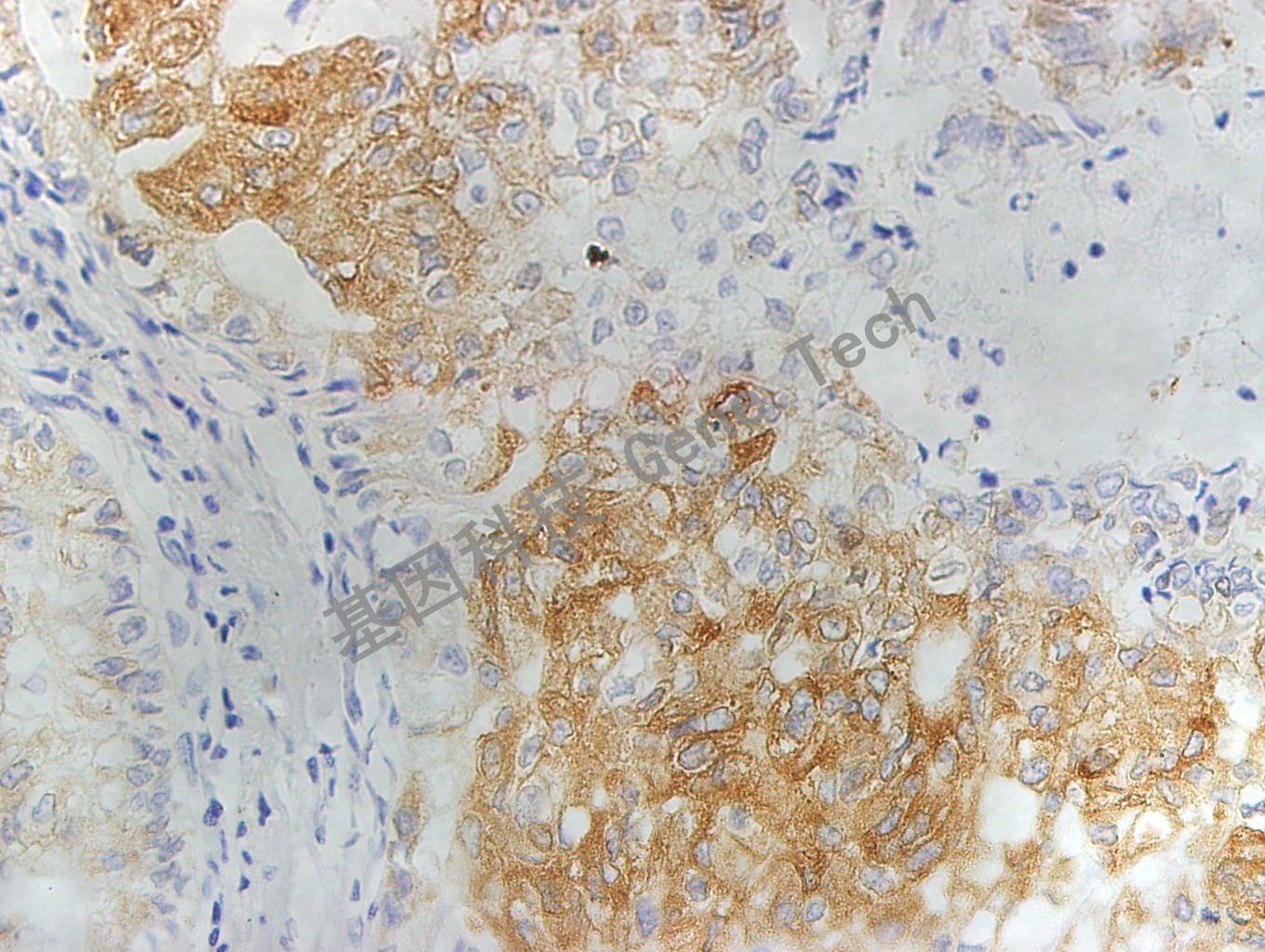 1683535427564235.jpg 1683535427564235.jpg