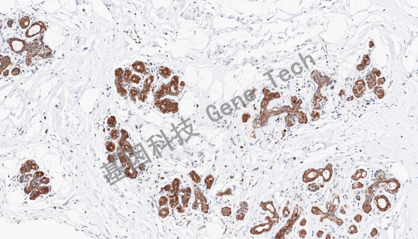 1704854446193480.jpg 1704854446193480.jpg