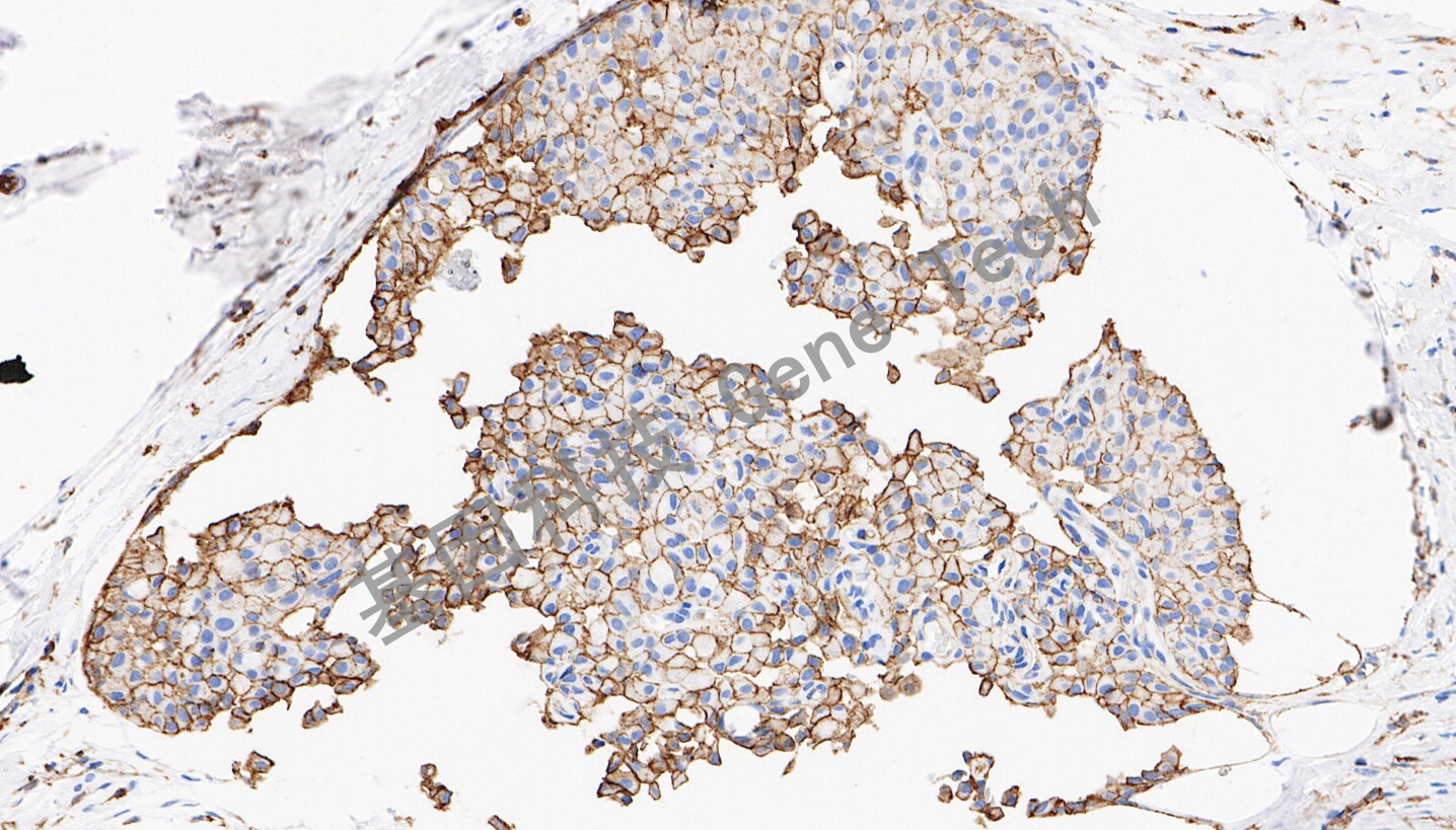 1724678122132086.jpg 1724678122132086.jpg